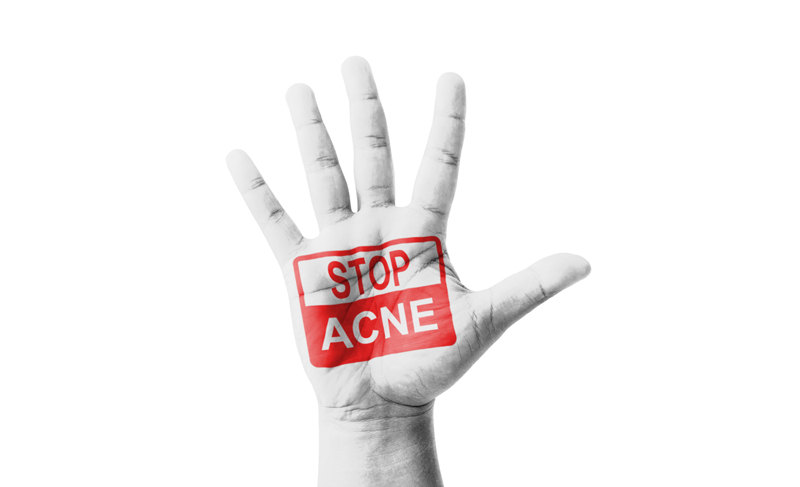 Tips to Reduce Acne Lesions Quicker