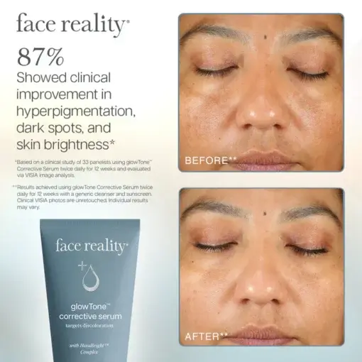 GLOWTONE™ CORRECTIVE SERUM - Face Reality - Image 4